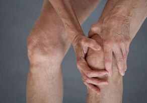การจับตัวเองของหัวเข่าด้วย arthrosis